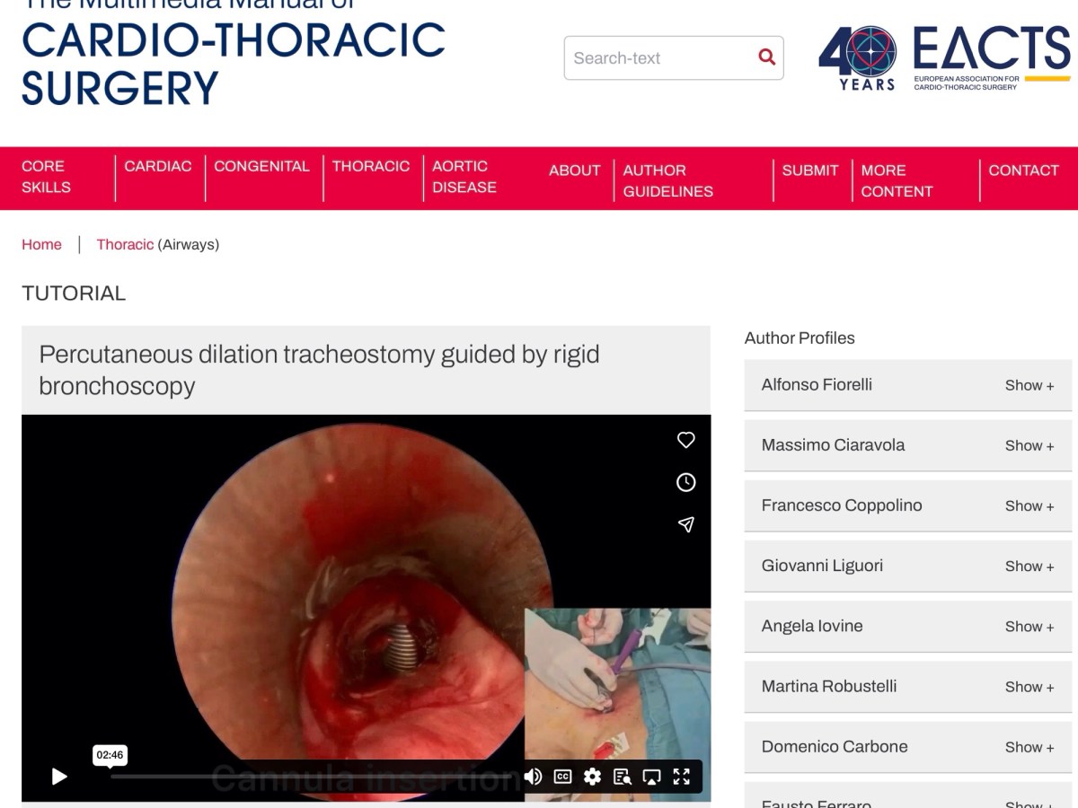 Tracheostomia percutanea con broncoscopio rigido nei pazienti con vie aeree&nbsp;difficili&nbsp;